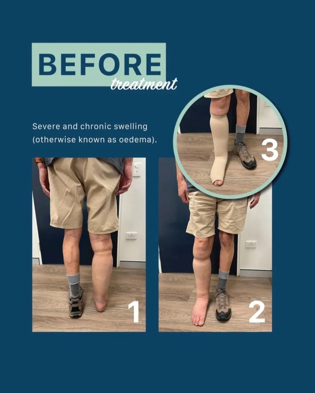 CASE STUDY TWO