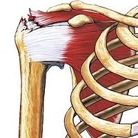 An illustration of the shoulder joint showing bones, muscles, and ribs.