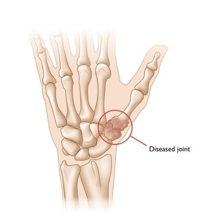 thumb.jpg