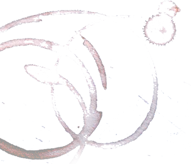 Drawing of a stethoscope with a pink tube, placed against a light background.