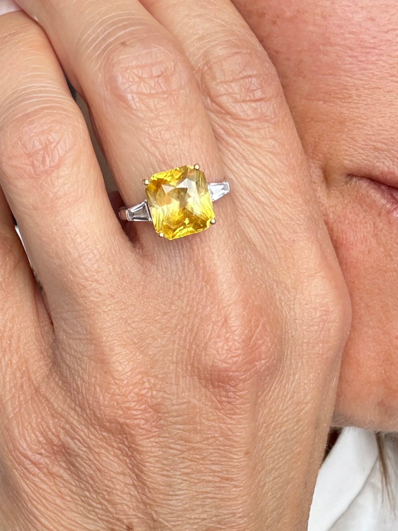 Yellow Sapphire and Diamond Ring