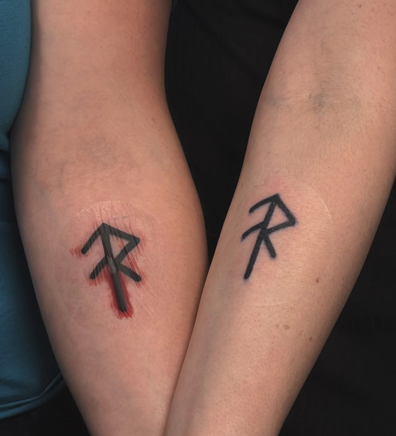 Two arms with matching tattoos of a runic symbol, with the left tattoo appearing slightly red and irritated.