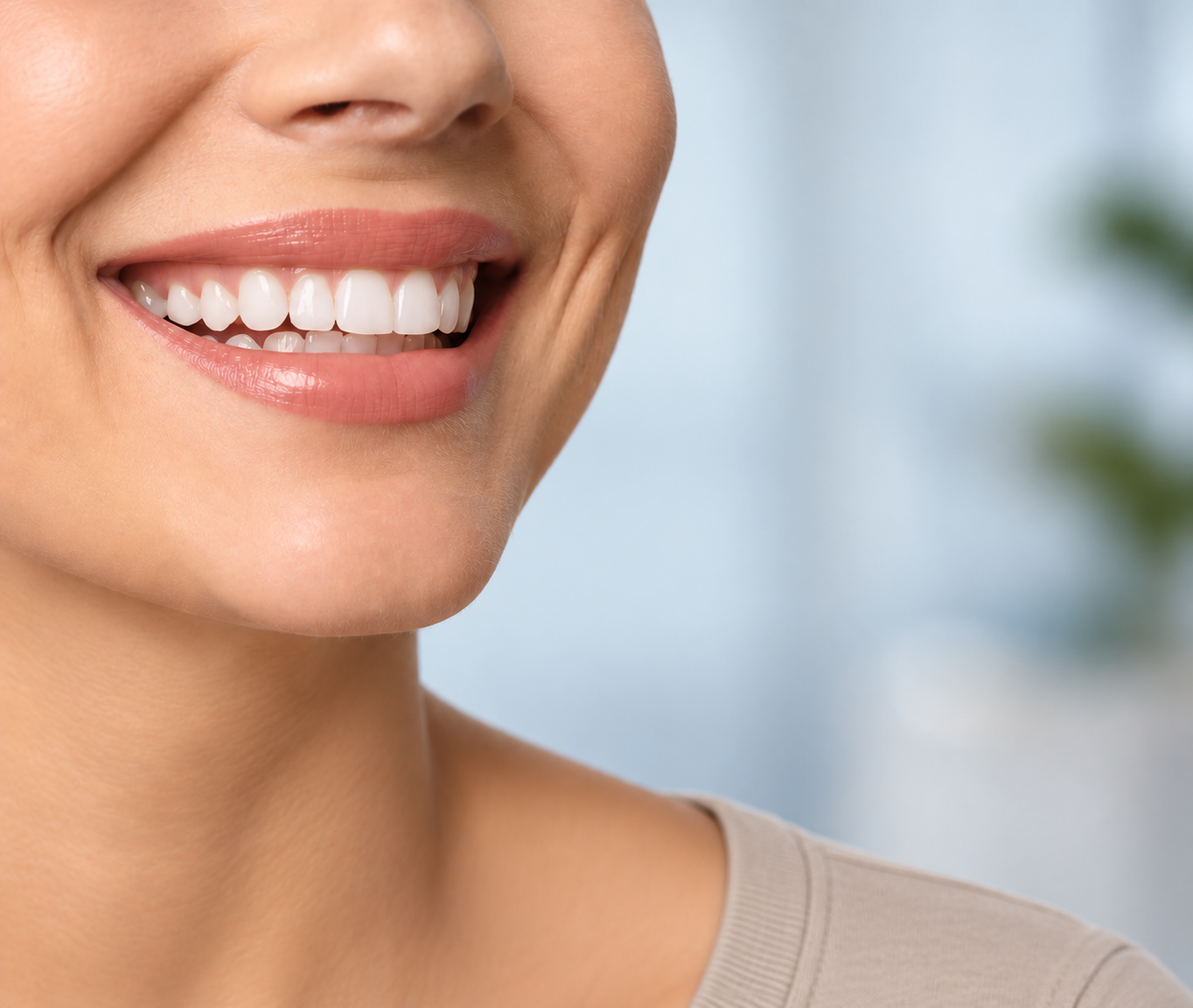 Gummy Smile treatment (illustrative)