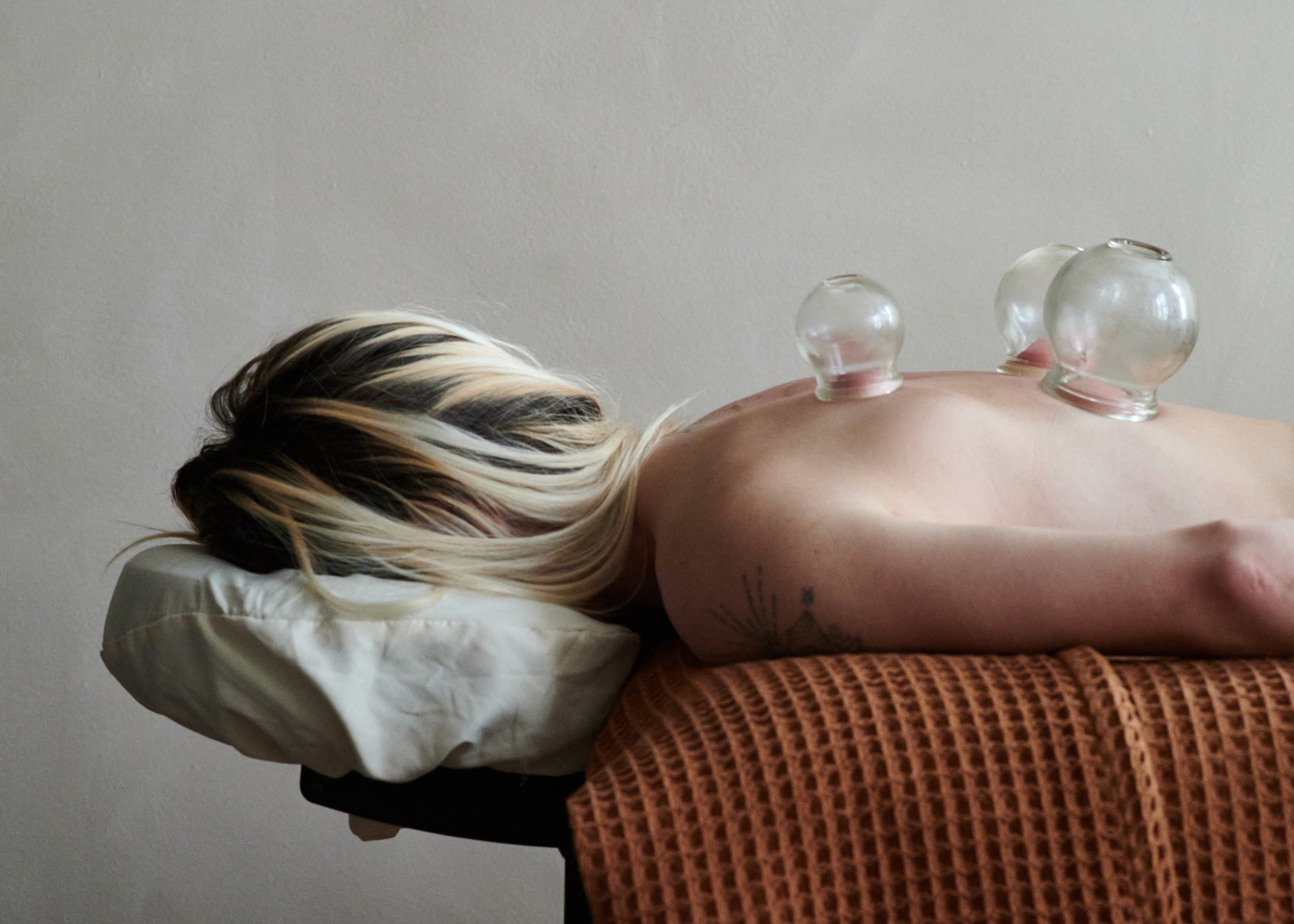 A woman with blonde and black hair is lying face down on a massage table, receiving cupping therapy with several glass cups on her back.