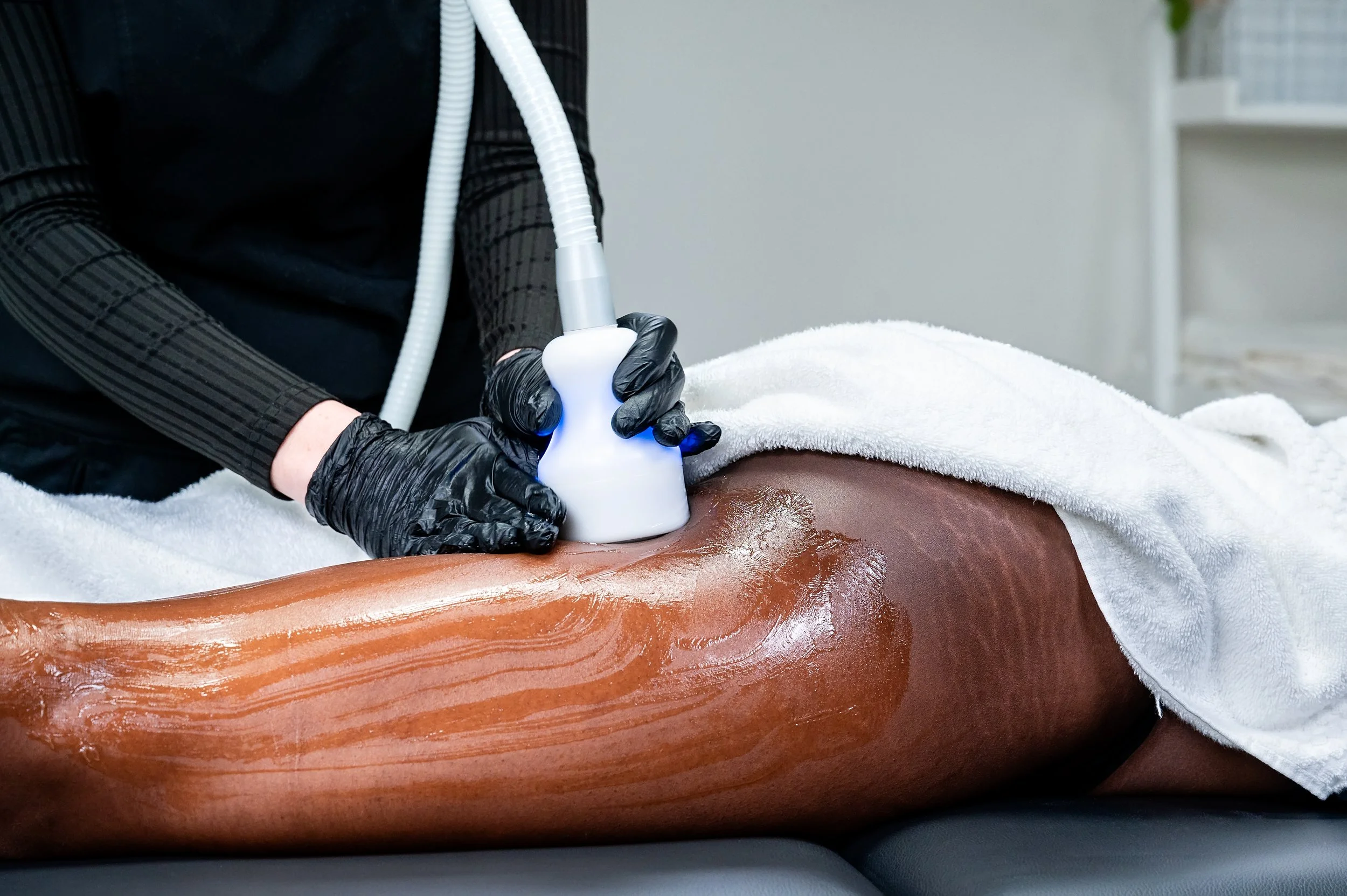 CryoToning