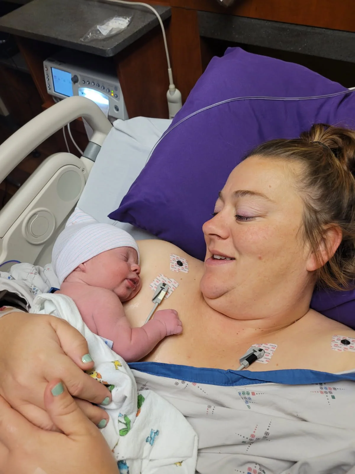 A woman lying in a hospital bed holding a newborn baby. The baby is wearing a hospital hat and is touching the woman's chest. The woman is smiling and looking at the baby, who has a medical device attached to their chest.