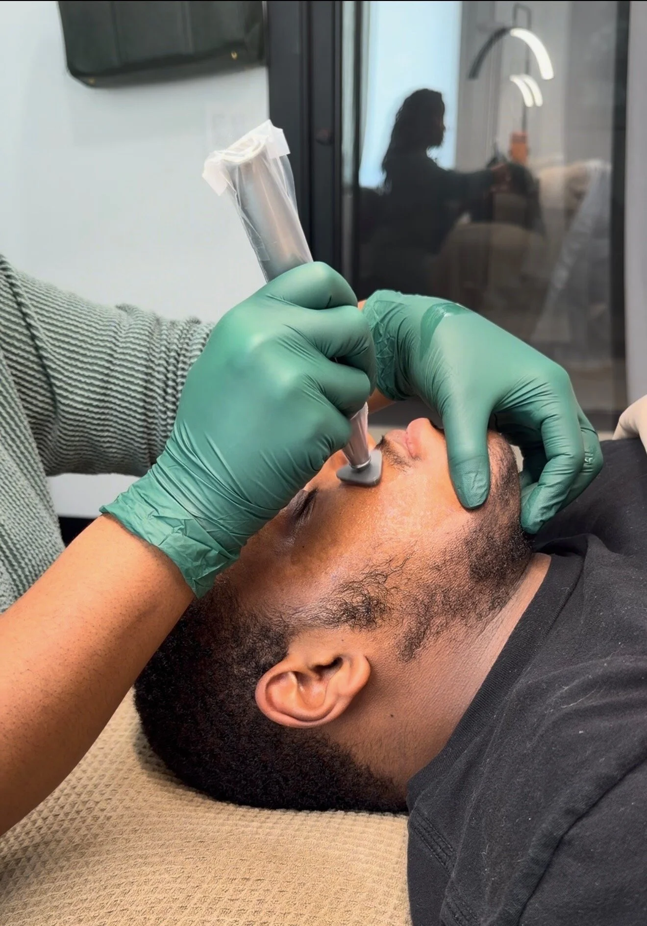 microchanneling microneedling at MCH Aesthetics in king of prussia PA