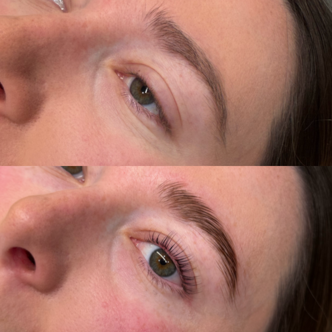 The best lash lifts at MCH Aesthetics in king of prussia philadelphia