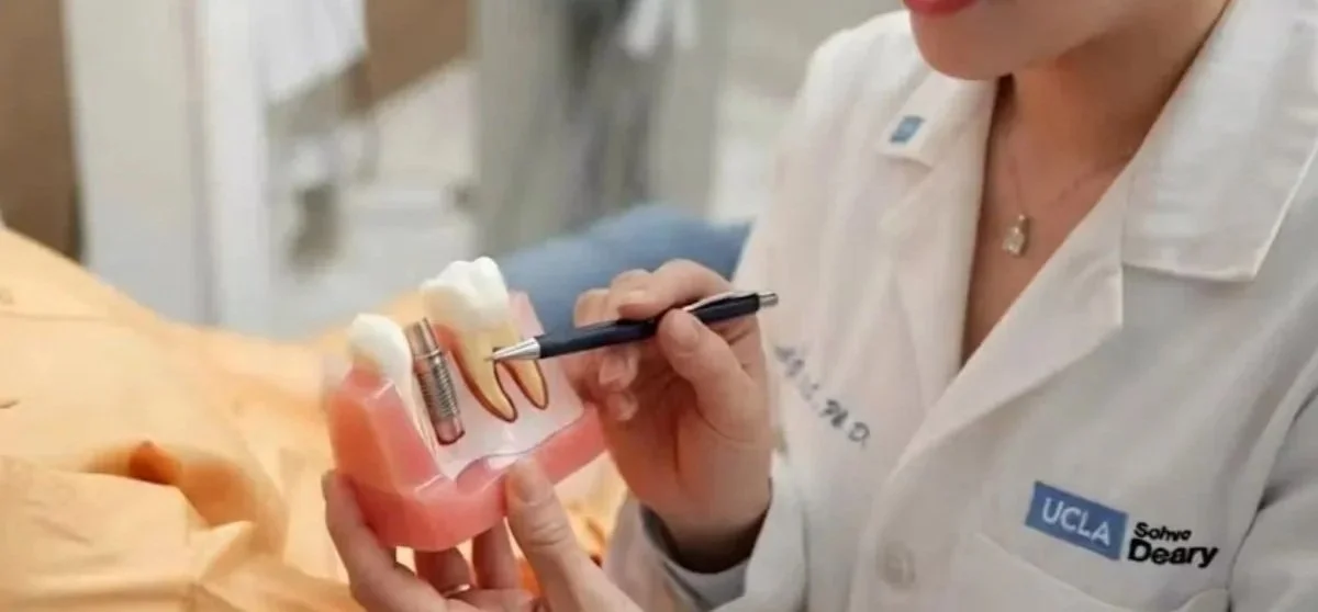 A person in a white UCLA-branded lab coat demonstrates a dental implant procedure using a model of teeth and gums with an implant screw.