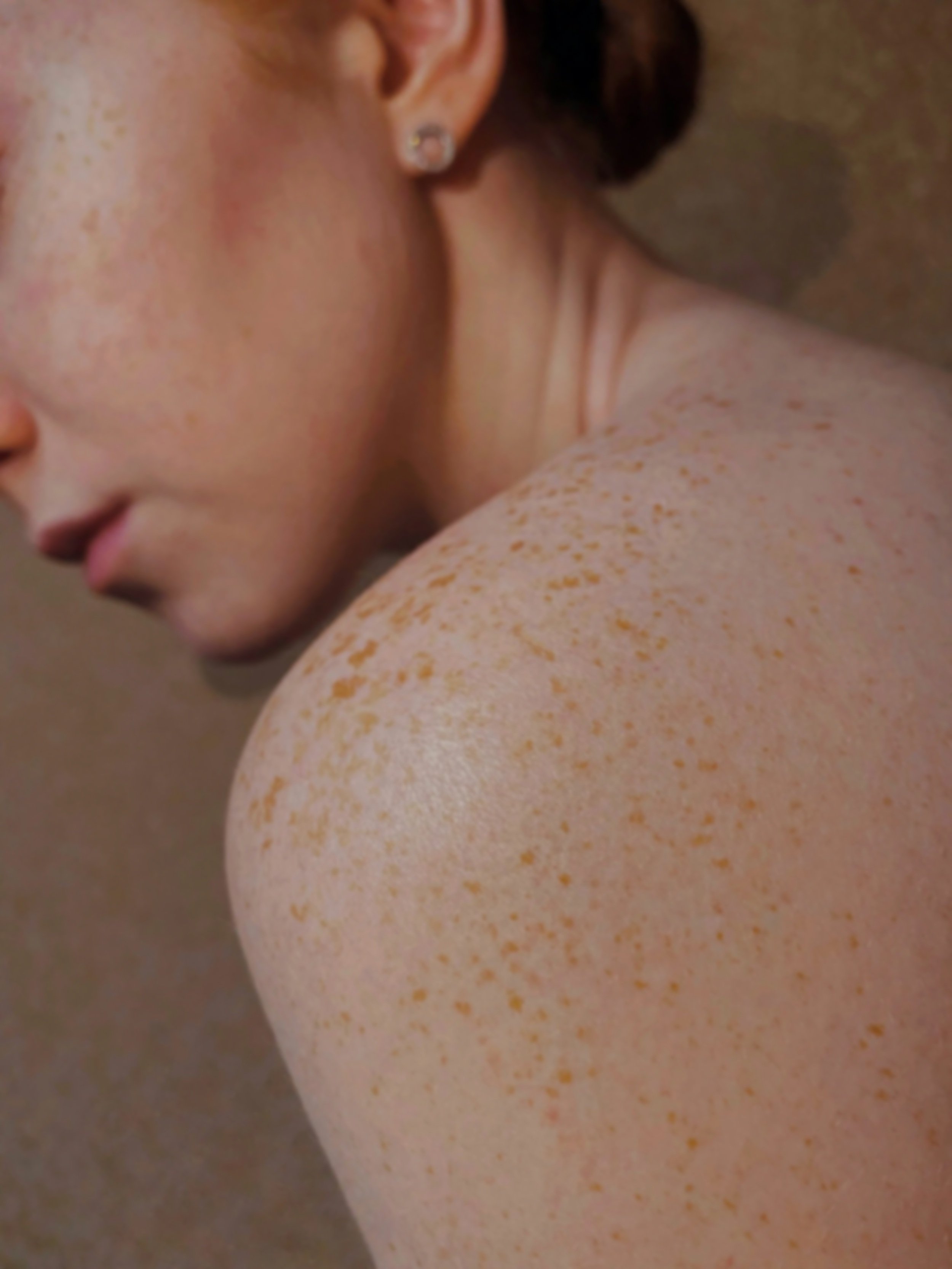Close-up of a person's shoulder and neck area with freckles, short brown hair, and a small earring.
