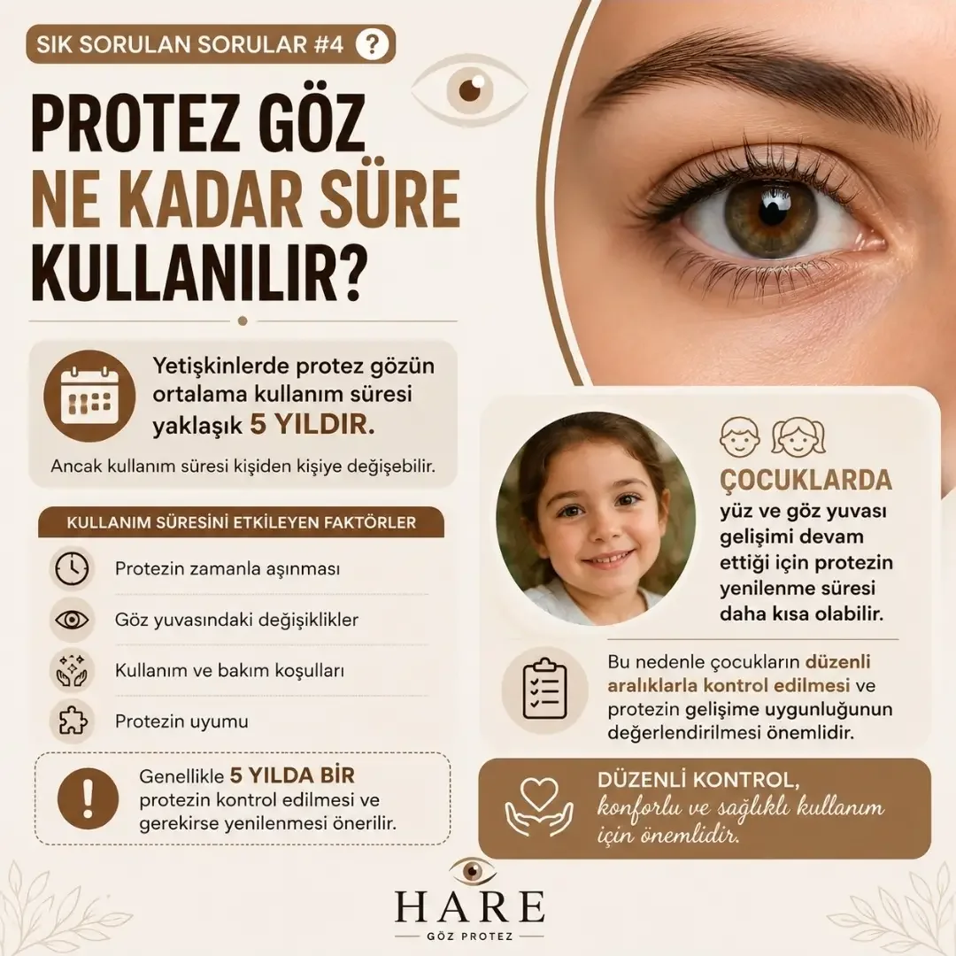 Göz protezinin kullanımı ve bakım süresi hakkında bilgiler içeriyor. Yetişkinlerde yaklaşık 5 yıl, çocuklarda ise daha kısa süre kullanılabilir. Kullanım süresini etkileyen faktörler, protezin zamanla aşınması, göz yuvasındaki değişiklikler, kullanım ve bakım koşulları ile uyuma uygunluğudur. Düzenli kontrol ve bakımın önemi vurgulanıyor.