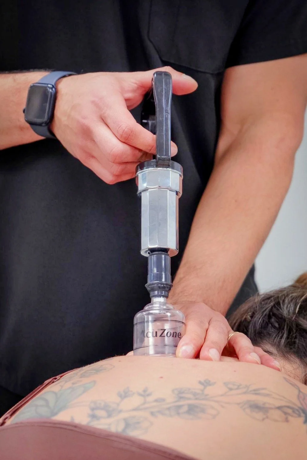 A person receiving a cupping therapy treatment on their back using a specialized glass device.