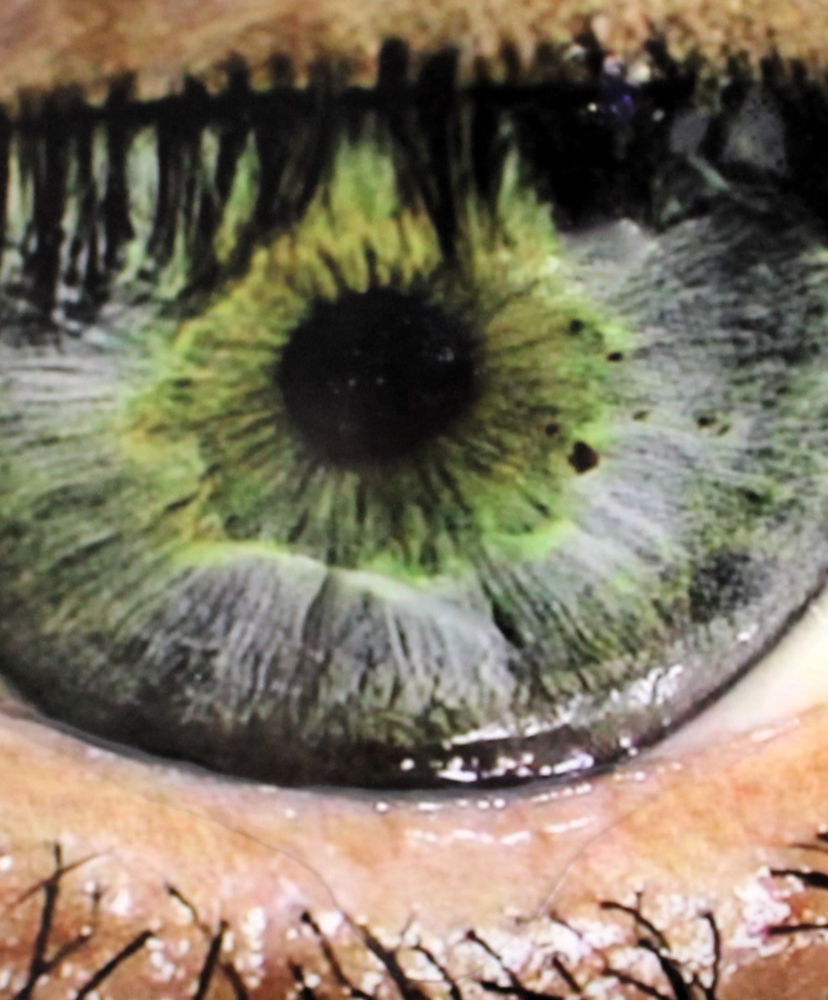 zoom.PNG
