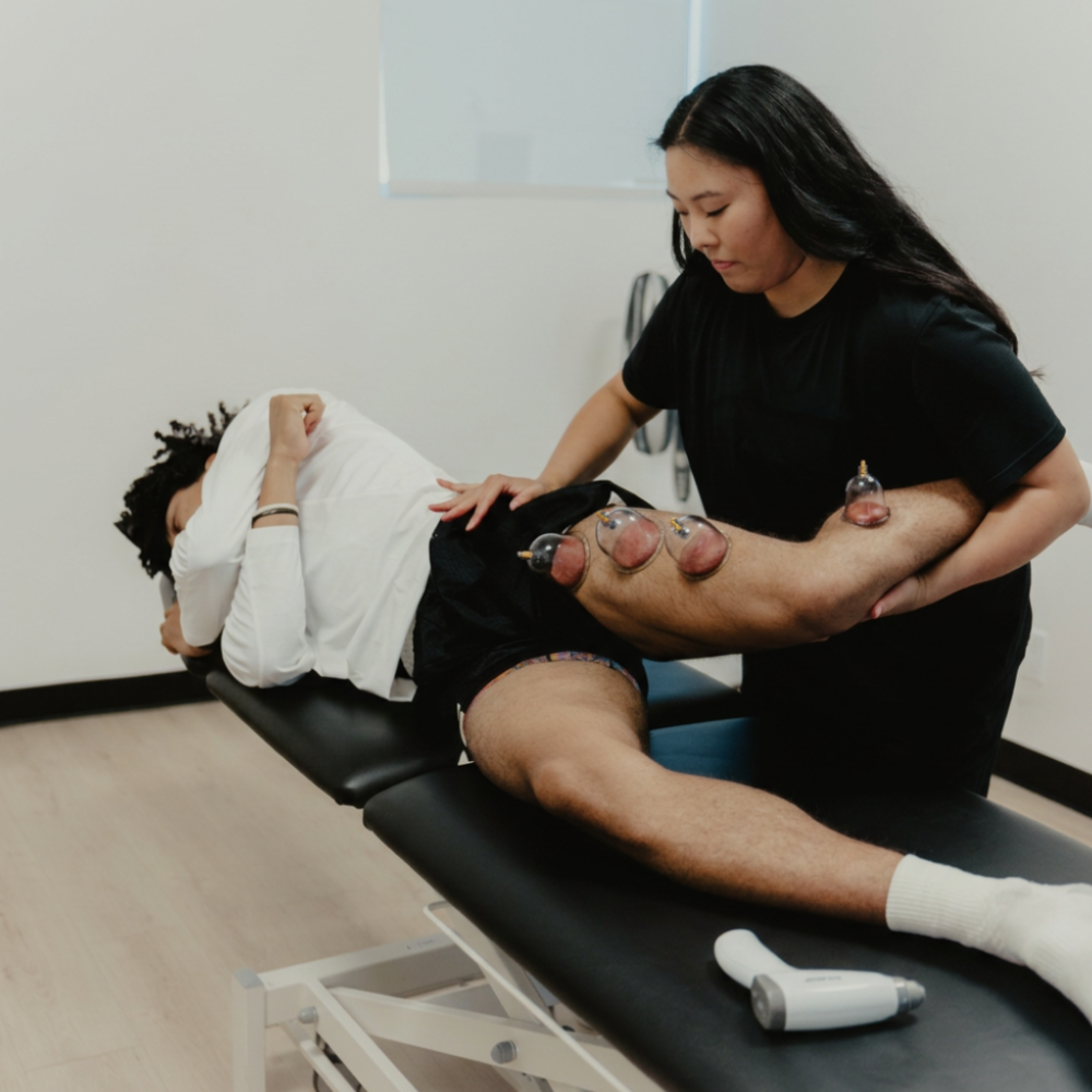 A woman receiving cupping therapy on her right thigh while lying on a treatment table, with a practitioner applying the cups.