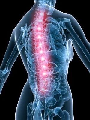 What's a Subluxation of the Spine? And How To Fix It.
