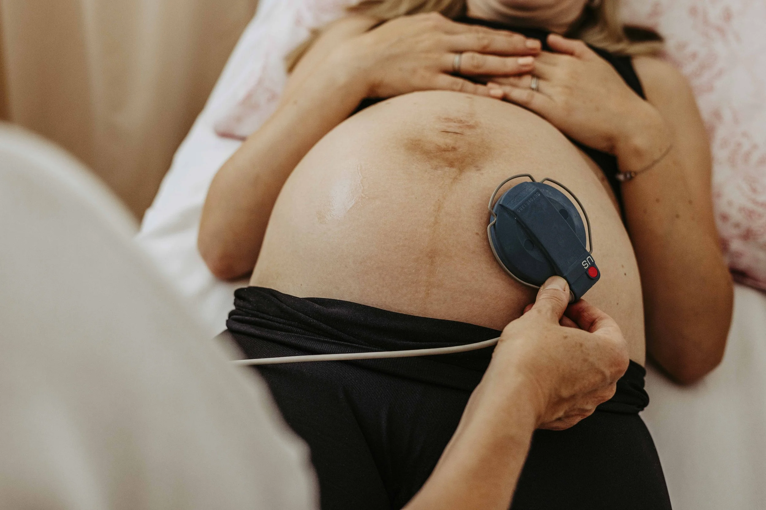 Eine schwangere Person liegt auf dem Rücken und wird mit einem Doppler-Herzmonitorempfänger am Bauch untersucht.