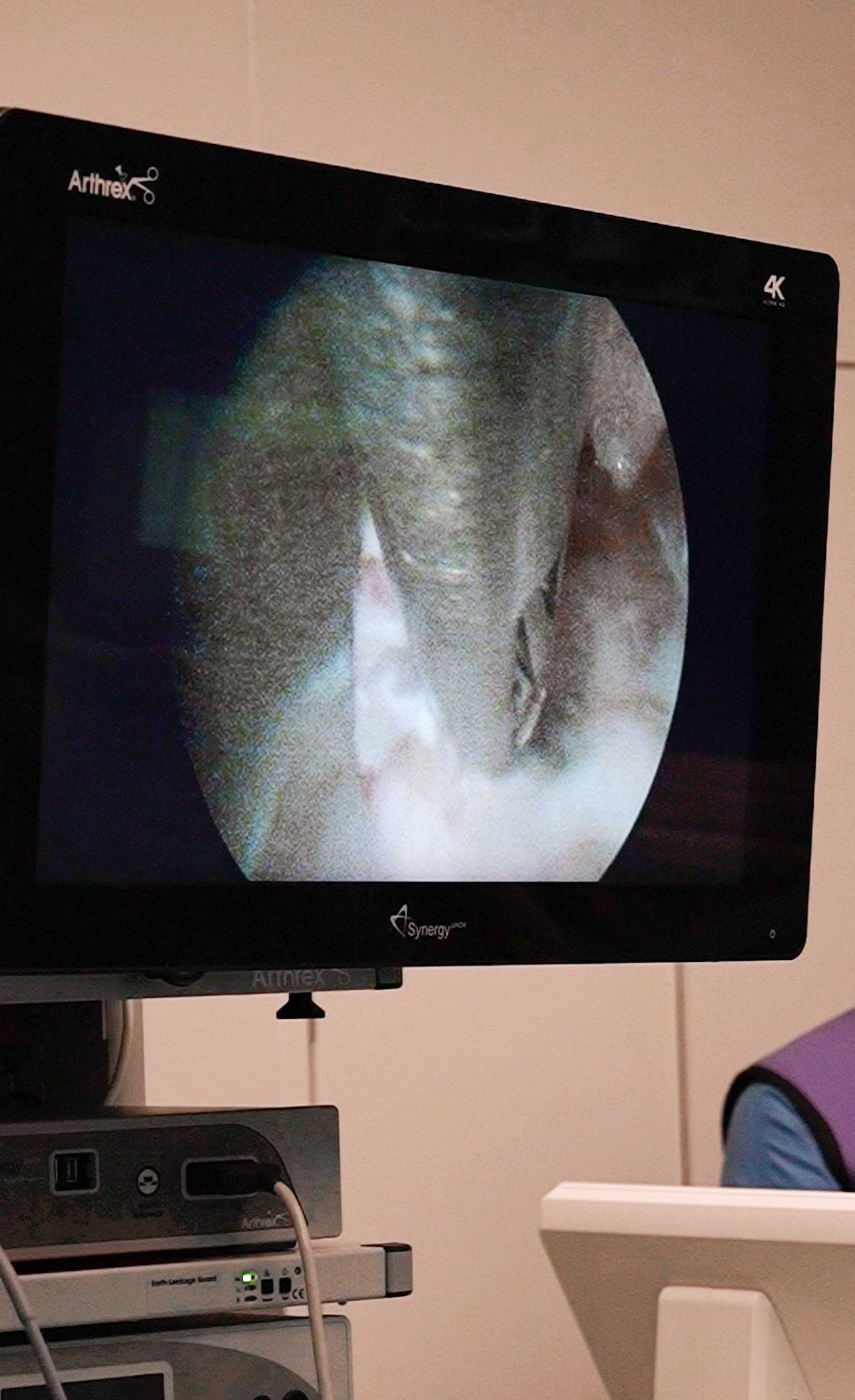 Ein Monitor zeigt eine 3D-Darstellung eines Körperteils, vermutlich eines Gelenks, in einer medizinischen Untersuchung. Es sind technische Geräte und Kabel darunter sichtbar.