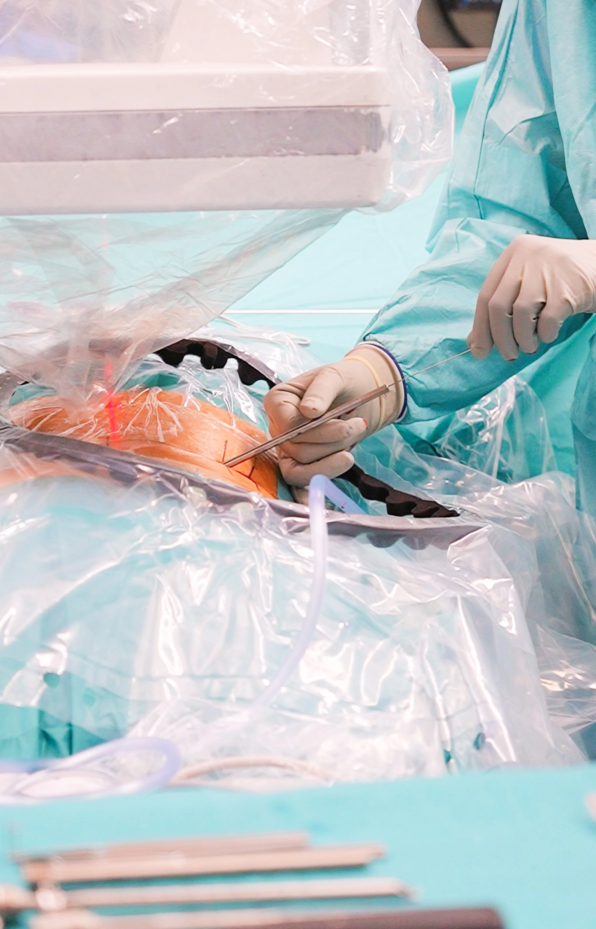 Ärztin führt eine Operation am offenen Herzen durch, während sie im Operationssaal arbeitet.