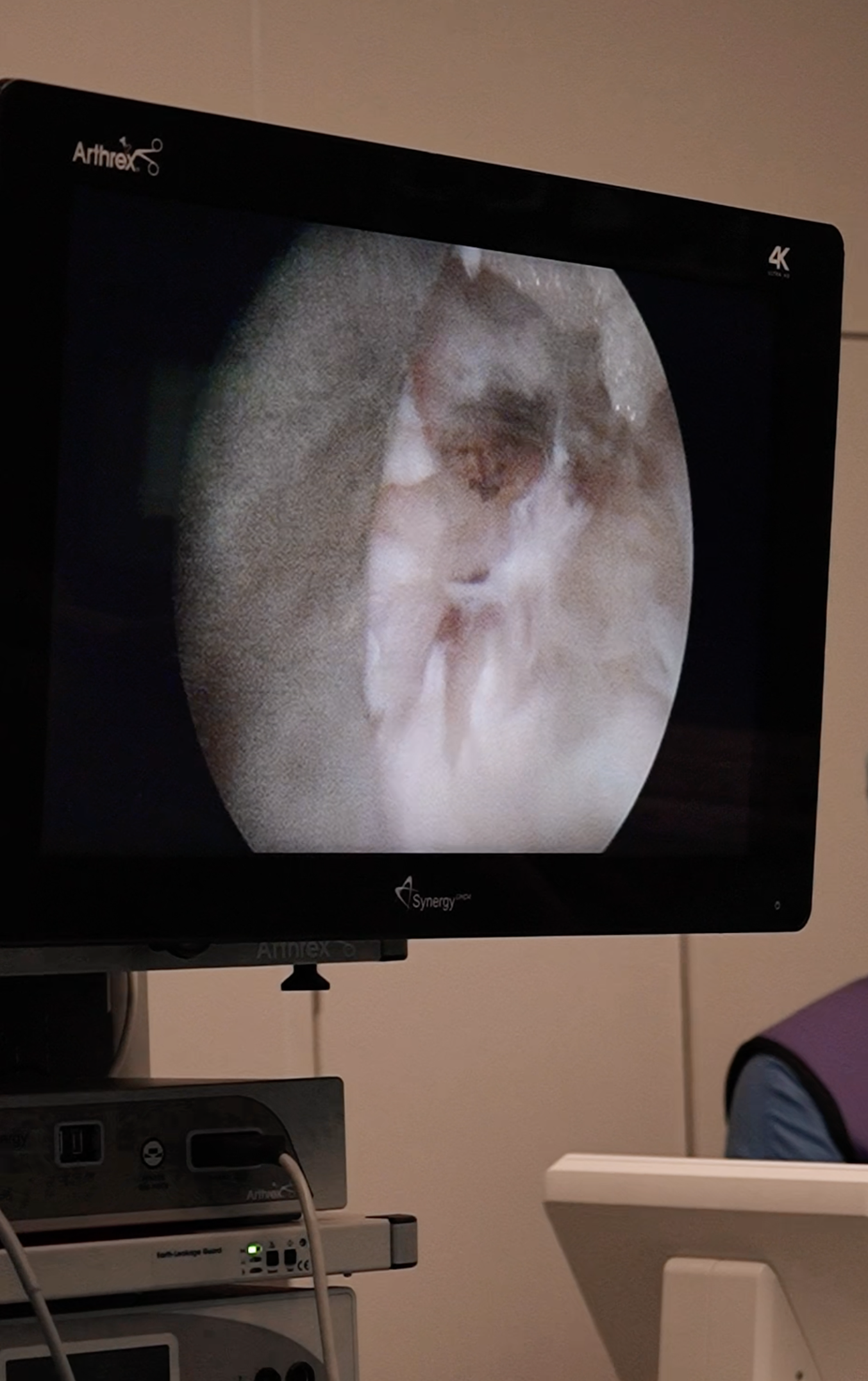 Der Bildschirm zeigt eine medizinische Ultraschalluntersuchung, vermutlich des Herzens, in 4K-Qualität.