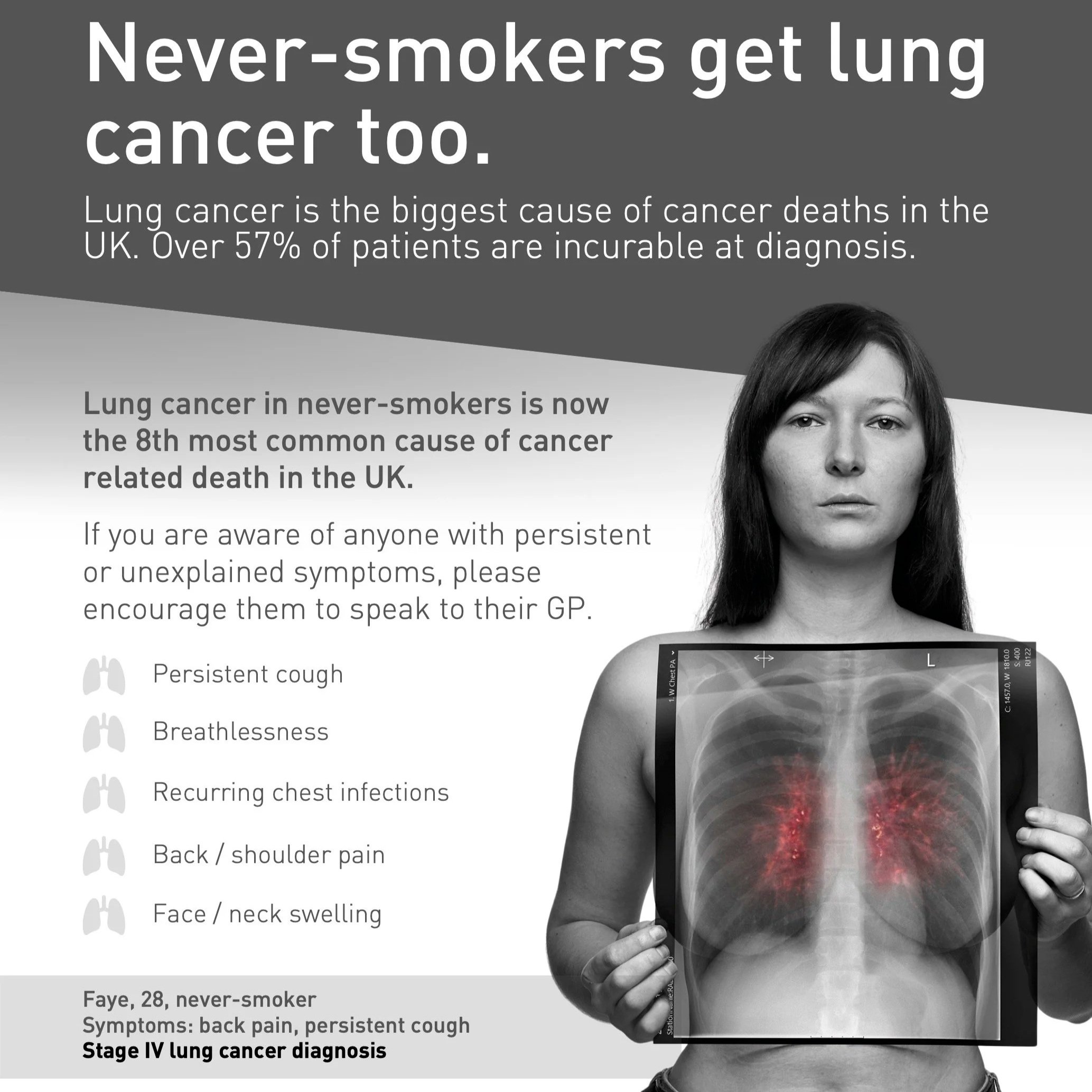 A young woman with dark hair holding an X-ray image of her chest over her stomach. The image contains medical information and symptoms related to lung cancer, including persistent cough, breathlessness, back or shoulder pain, and face swelling. The text discusses the dangers of smoking and highlights that lung cancer is the biggest cause of cancer deaths in the UK, with over 57% of patients being incurable at diagnosis.