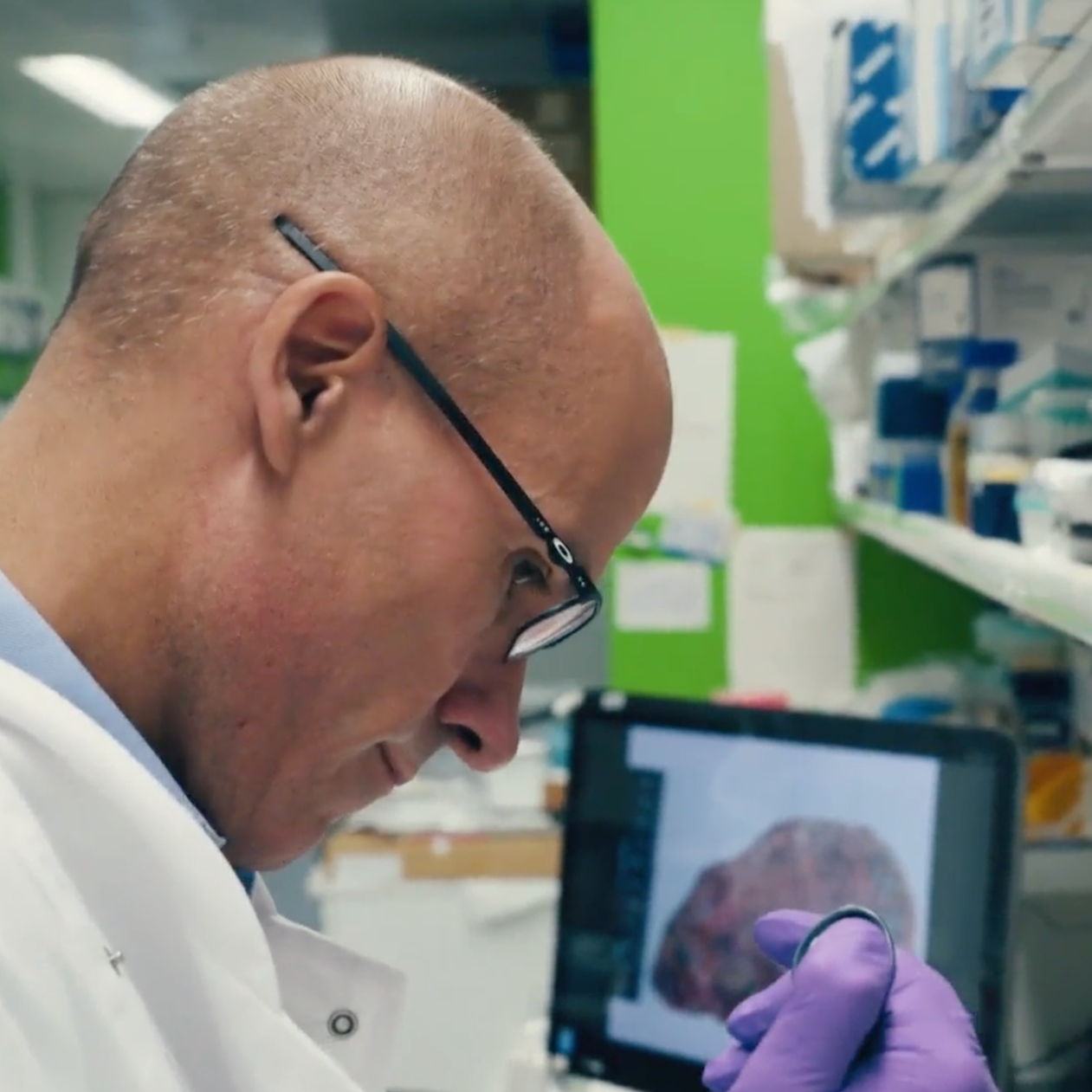 A scientist wearing glasses and purple gloves examining a sample with a microscope in a laboratory that has shelves and a computer screen displaying an image of a brain.