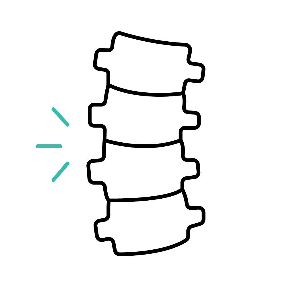 A simple line drawing of a spinal disc with four cushions stacked together, indicating a healthy spine or possibly a herniated disc.