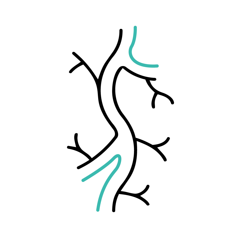 A black and white hand-drawn diagram illustrating nerve pain.
