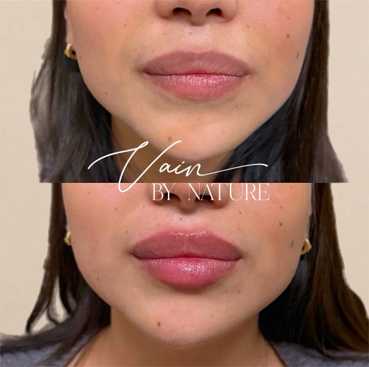 Just enough to have everyone wondering, 
&ldquo;Wait&hellip; did she get her lips done or &hellip;&rdquo;💉

Ready for your lip upgrade? Hit the link in my bio to book.

#NaturalResults #RanchoCucamongaInjector #InlandEmpireInjector #VBNAesthetics