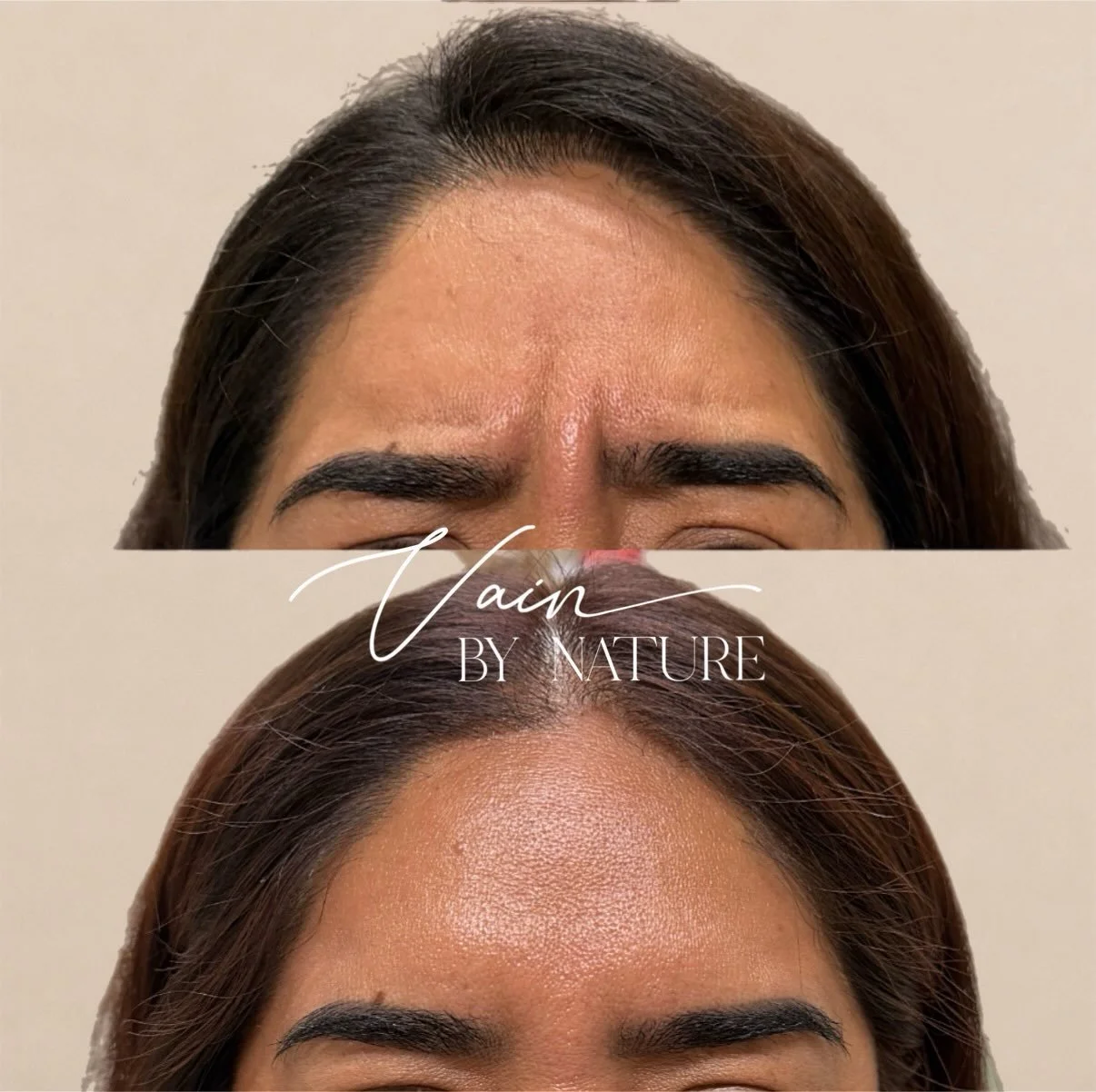 Just a little razzle dazzle 🧚💉

A few units here, a little magic there&hellip; and suddenly everything is smoother, fresher &amp; giving ✨

Because sometimes all you need is a little Tox.

📍Rancho Cucamonga, CA
Booking now through the link in bio 