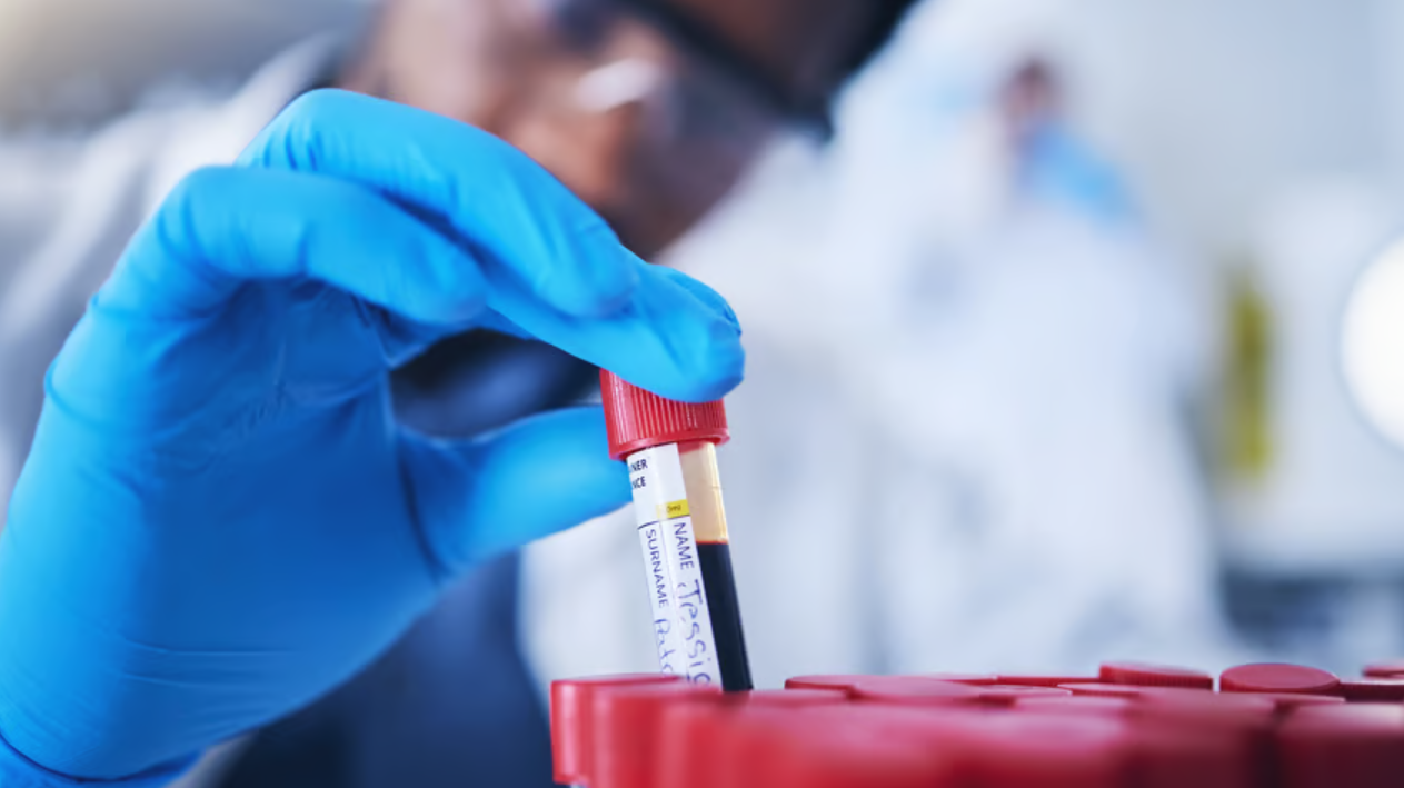 A scientist wearing blue gloves handling a blood sample in a laboratory.
