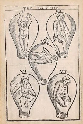 Unveiling the History of Childbirth: A Journey Through Time