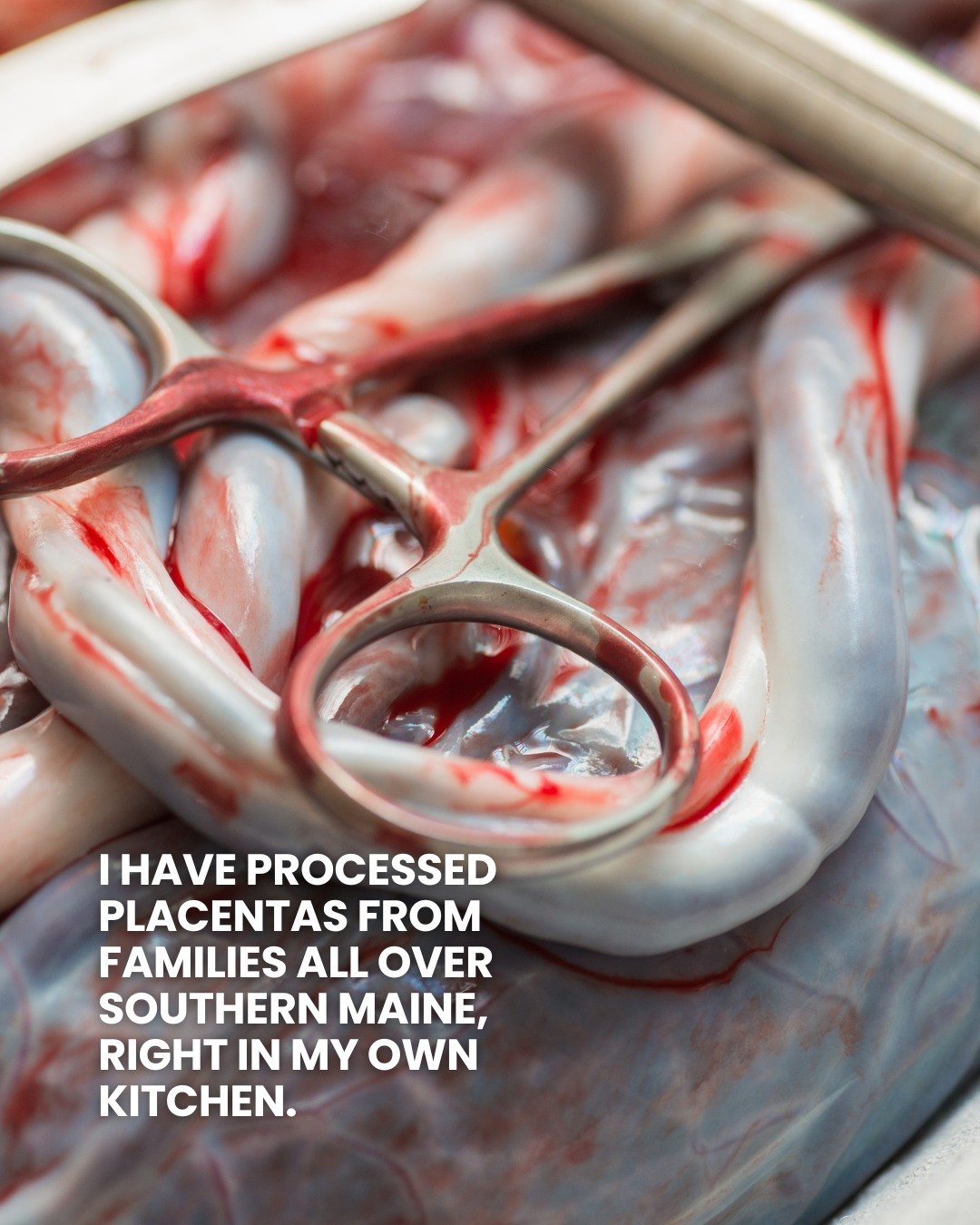Placenta encapsulation is a service that comes with a lot of curiosity and sometimes a little bit of doubt, and I get it. You are trusting someone with something deeply personal during one of the most vulnerable weeks of your life.

I am OSHA bloodbo