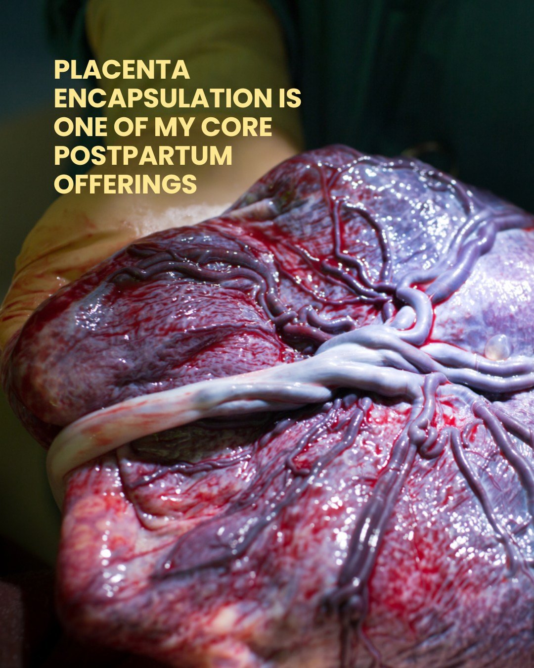 Placenta encapsulation gets a lot of attention, so I want to be clear about where it fits.

I see it as one piece of a bigger, holistic approach to postpartum care. On its own, it is not a fix for the fourth trimester. Alongside rest, nourishment, an