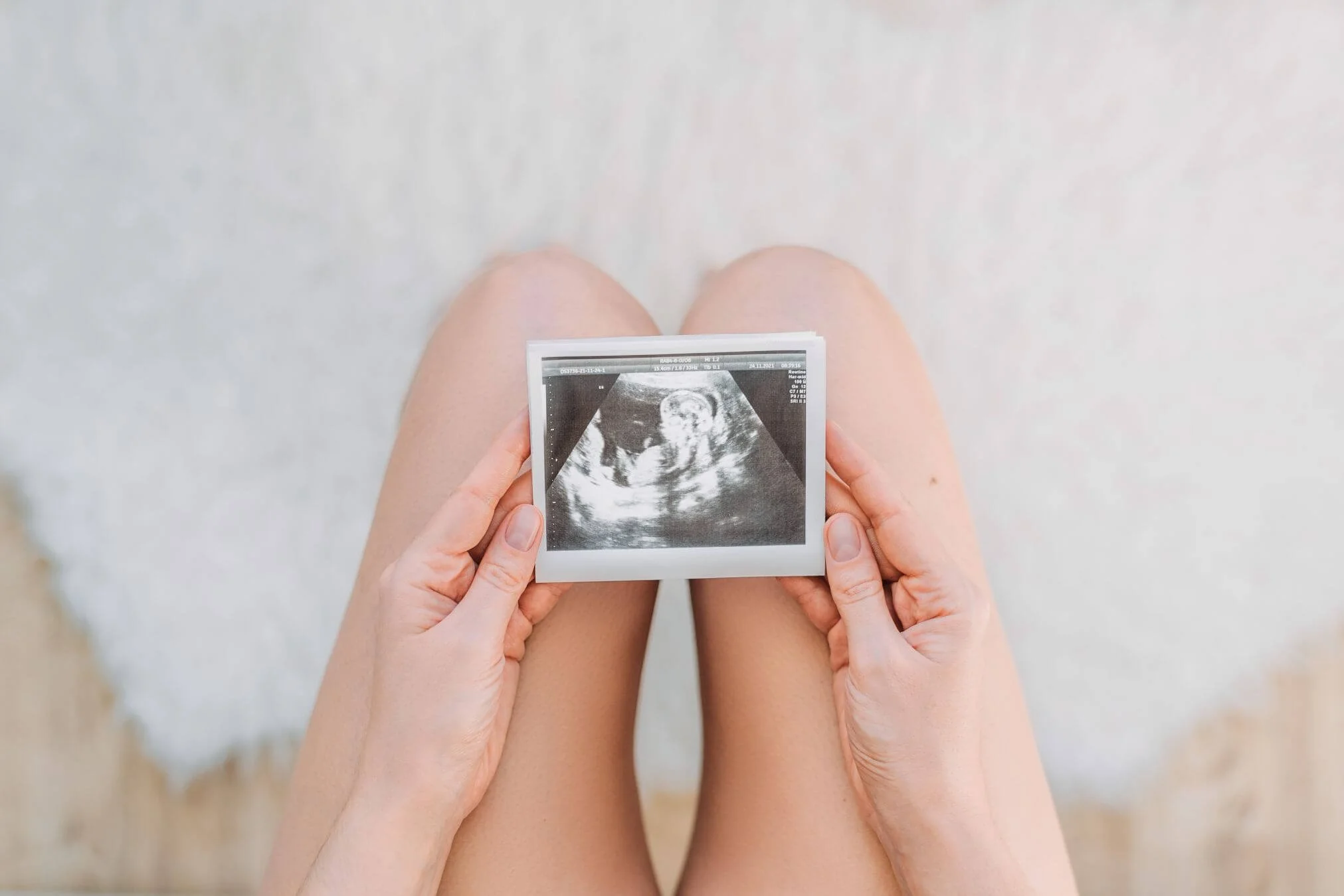 Person holding an ultrasound image while sitting on a white floor with bare legs visible.