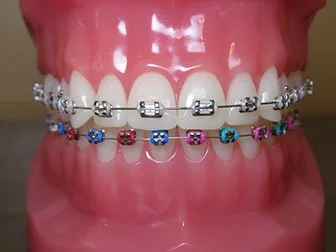 Braces