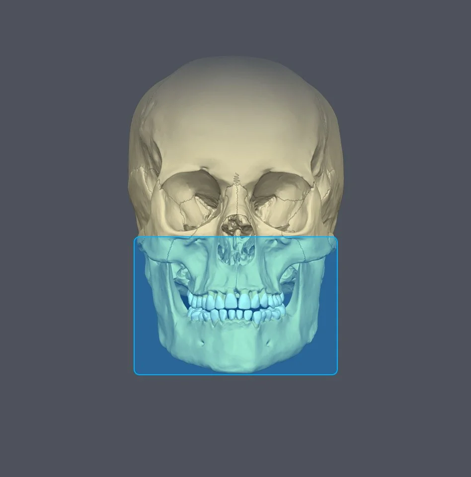 3D rendering of a human skull with the lower jaw highlighted in blue.