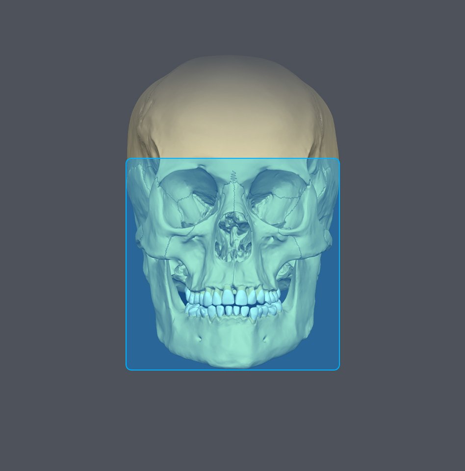 Digital 3D rendering of a human skull viewed from the front with a blue selected area around the lower face and teeth.