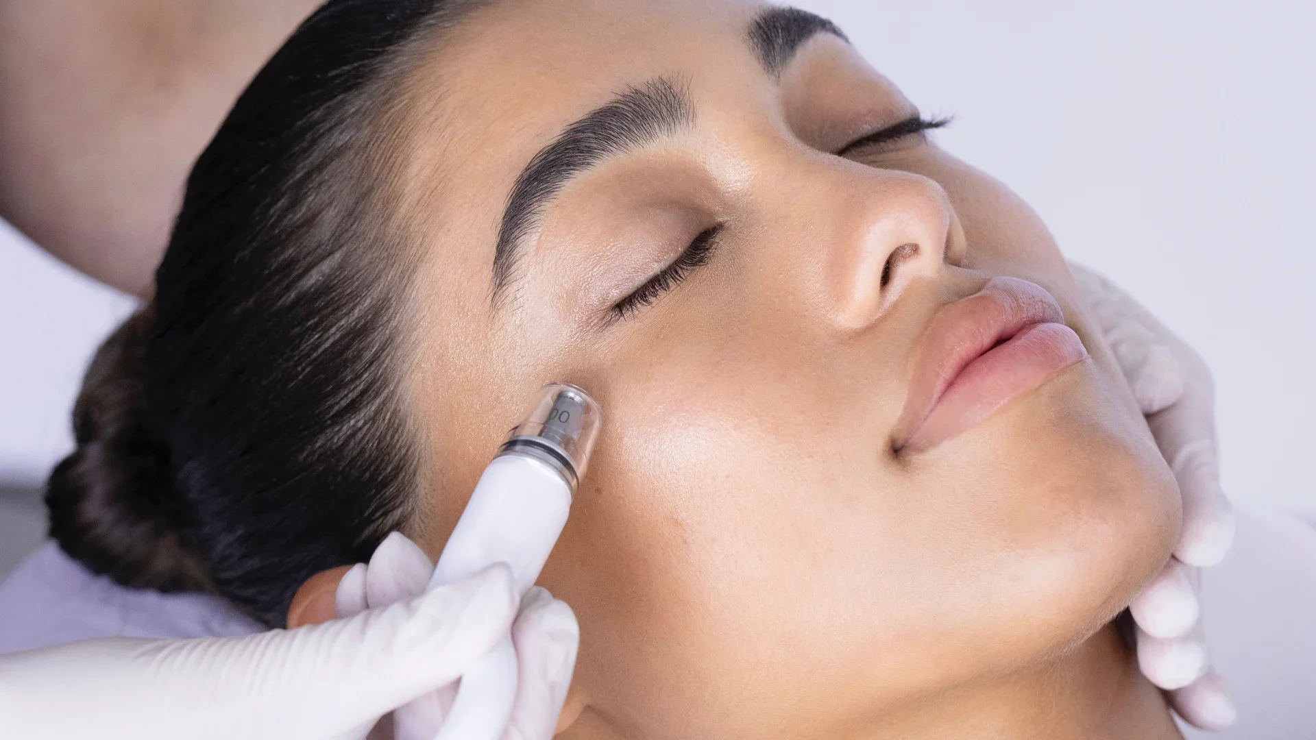 A woman receiving a cosmetic facial injection around her cheekbone area from a professional wearing white gloves.