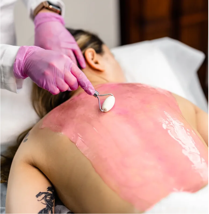 Woman receiving a back facial