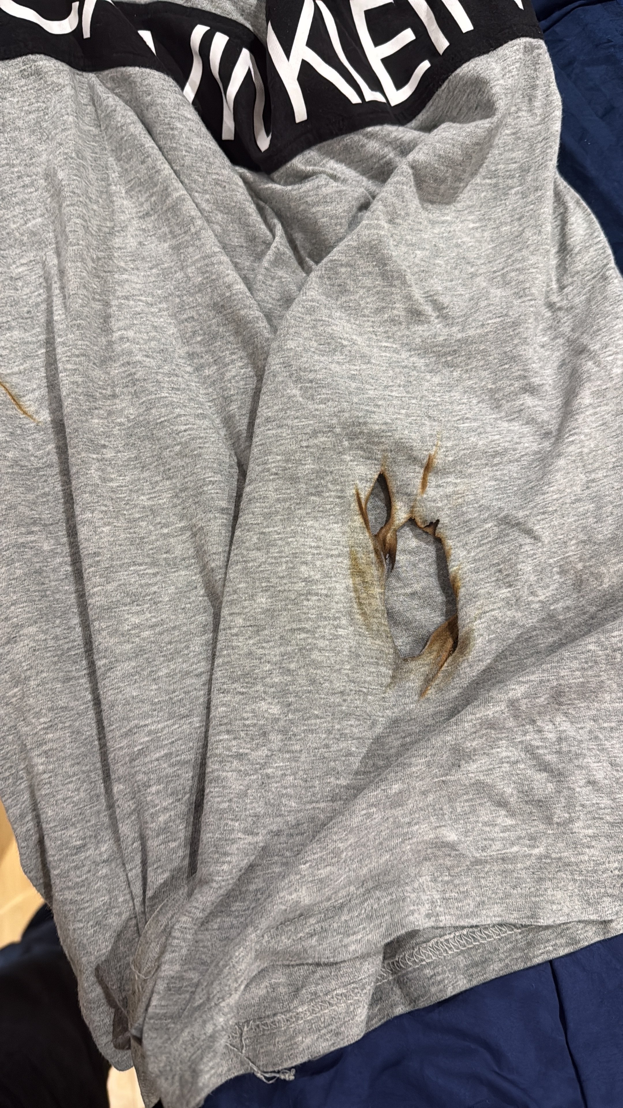 A gray sweatshirt with a hole in the fabric, exposing the skin underneath.