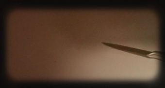 A close-up of a knife or surgical instrument against a dark background.