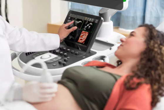 A medical professional performing an ultrasound on a woman lying on an examination table.