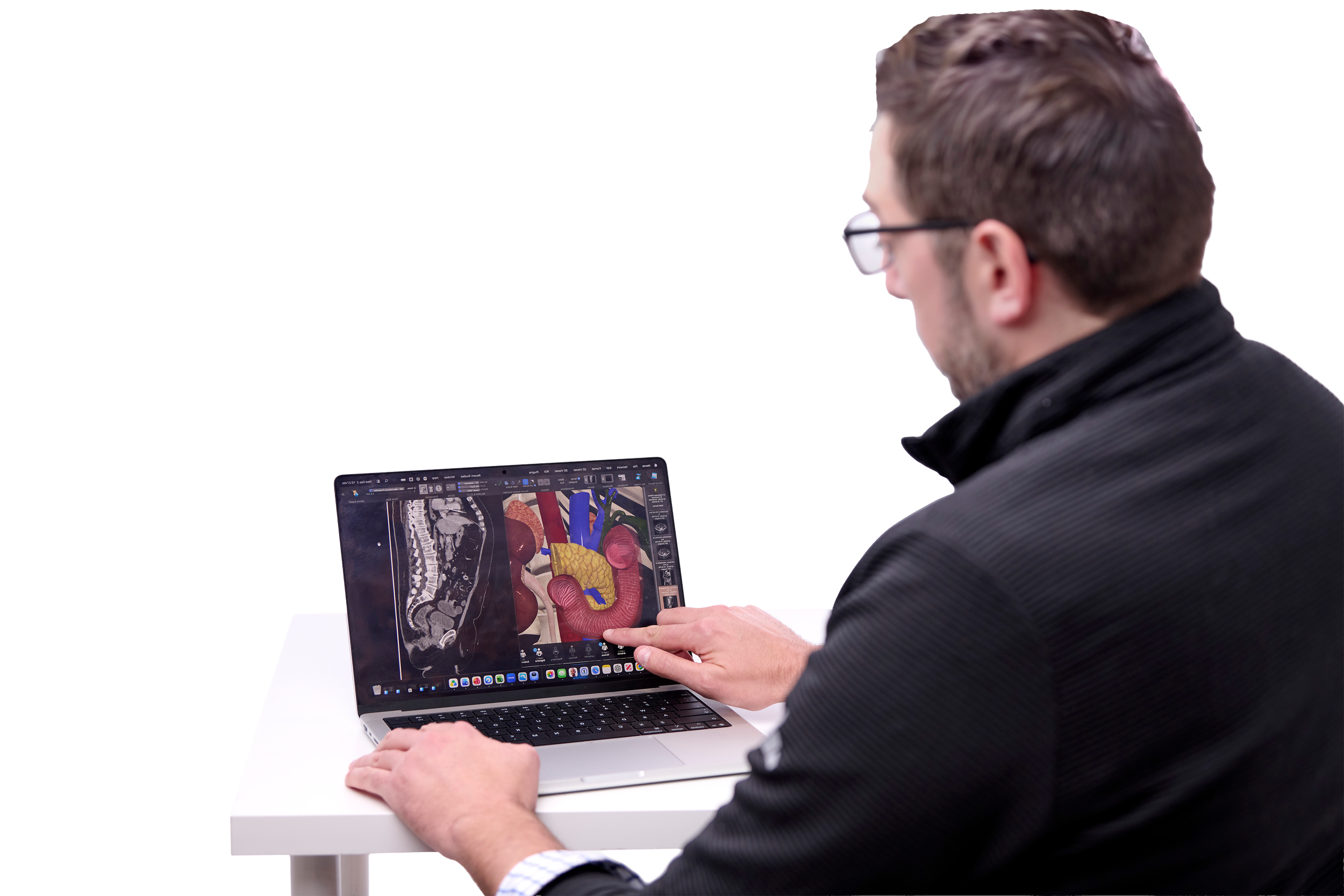 A man in a black jacket and glasses using a laptop with a detailed 3D rendering of human internal organs on the screen.