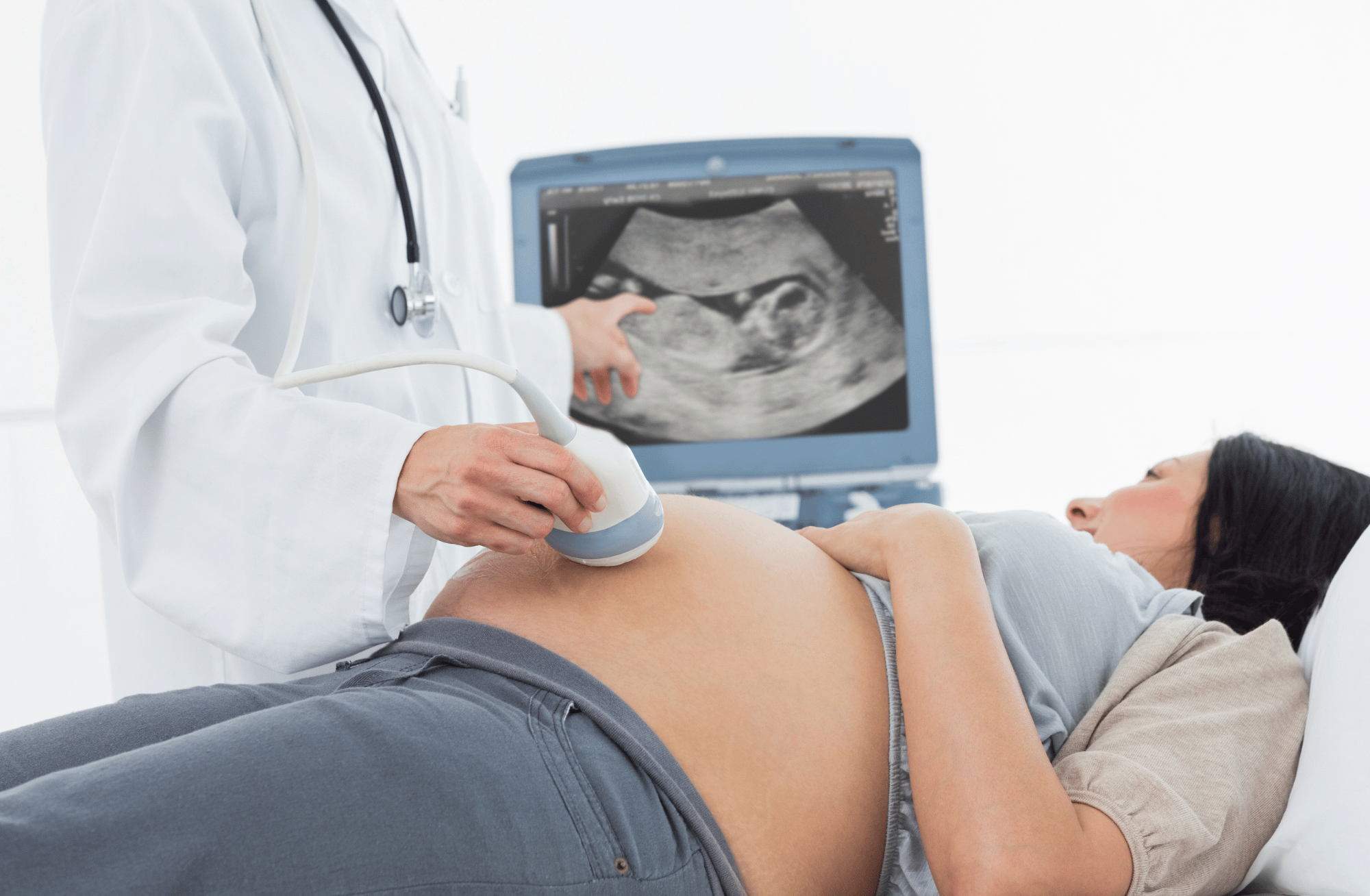 Doctor performing an ultrasound on a pregnant woman lying on an examination table, with a monitor displaying the ultrasound image.