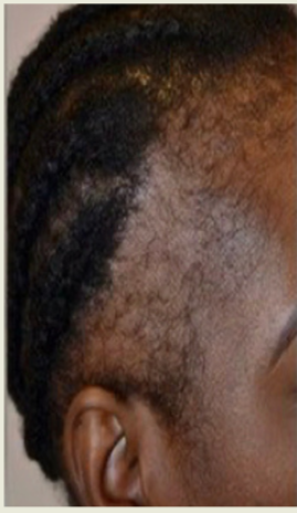 Why Your Edges Thin — and What the Science Actually Says