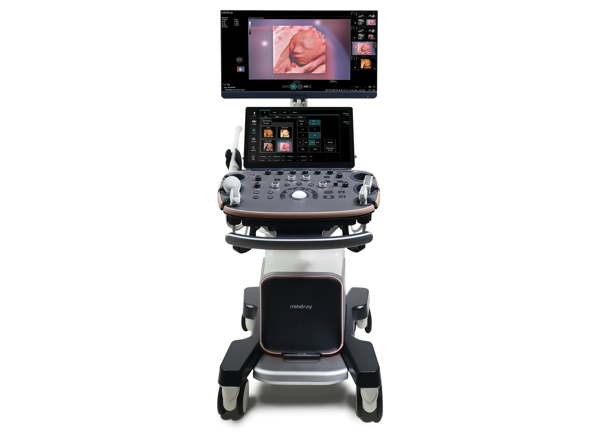 Mindray Imagyn I9 for Women's Health
