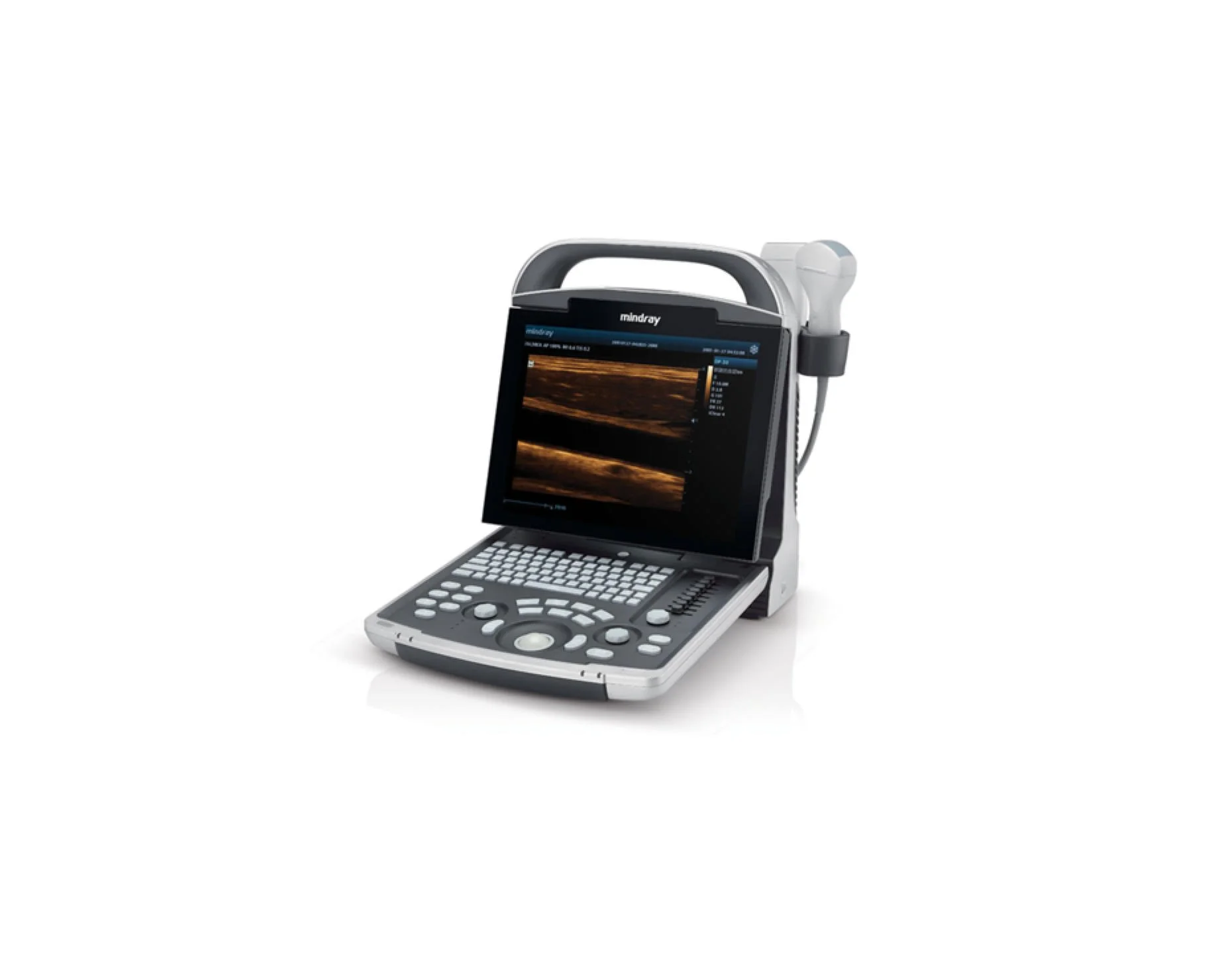 Mindray DP-30