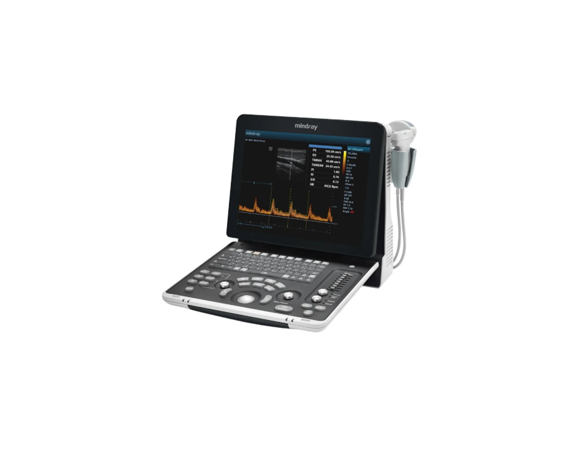 Mindray DP-50 Expert