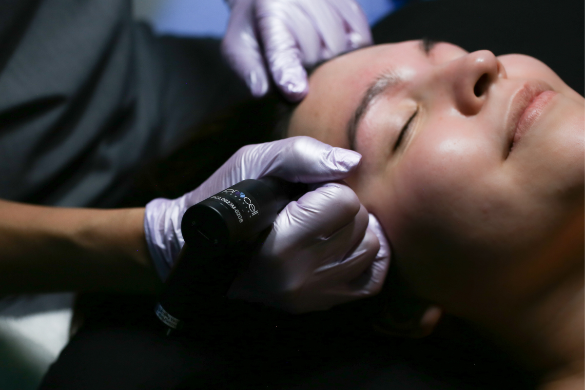 A woman receiving a microchanneling facial treatment with a device on her face, lying down with eyes closed, at a spa near henderson nv