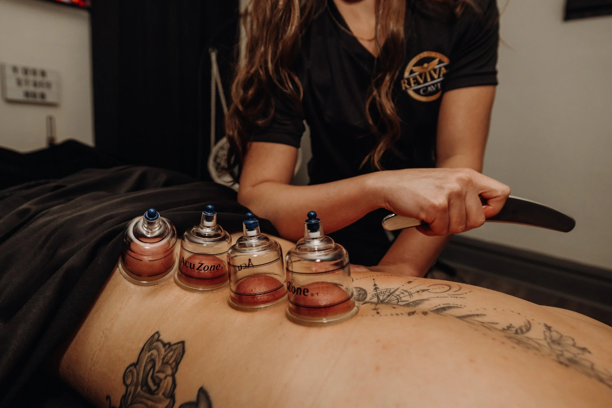 Person receiving a cupping therapy session with multiple cups placed on their back.